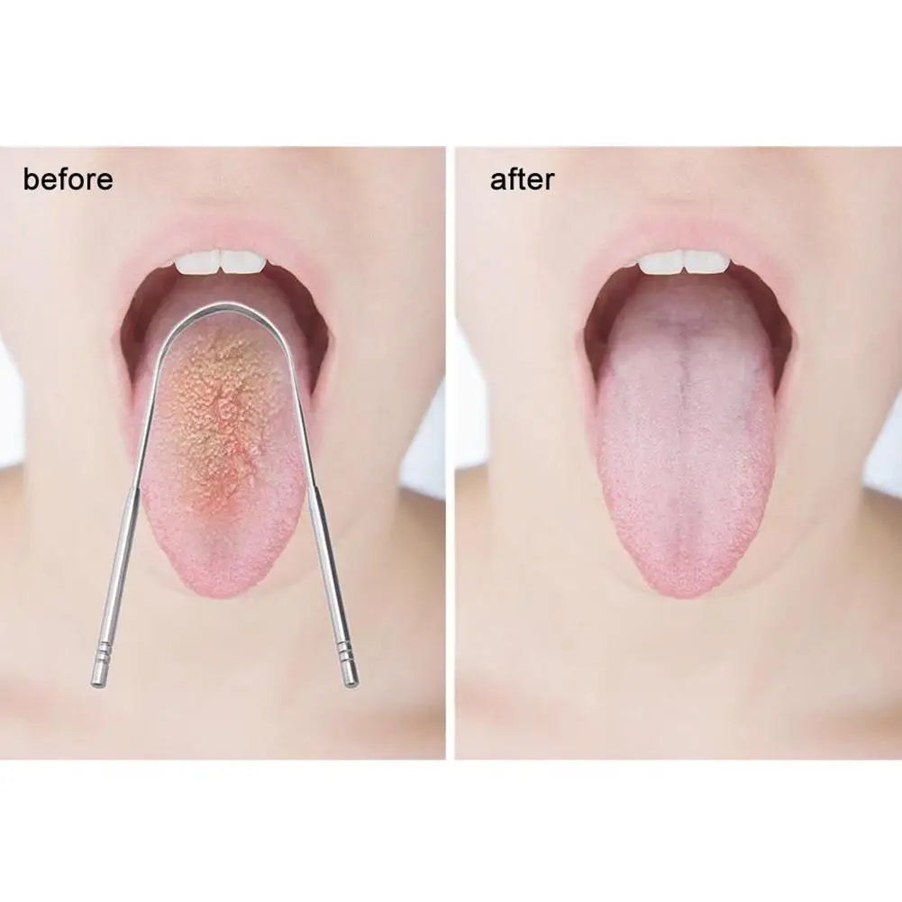 Stainless Steel Tongue Scraper for Fresh Breath & Hygiene